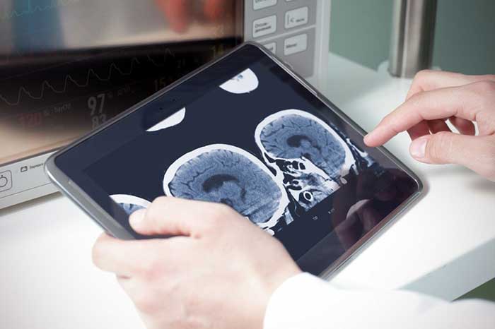 doctor examining a brain cat scan on a digital tablet